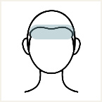 おでこ（眉間含む）